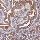 Immunohistochemical staining of human upper gastrointestinal shows moderate cytoplasmic positivity in glandular cells.