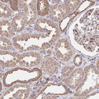 Immunohistochemical staining of human kidney shows moderate cytoplasmic positivity in cells in tubules.