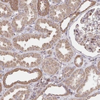 Immunohistochemical staining of human kidney shows moderate cytoplasmic positivity in cells in tubules.