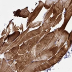 Anti-ST6GALNAC3 Antibody