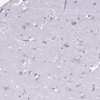 Immunohistochemical staining of human cerebral cortex shows weak cytoplasmic positivity in subset of neurons.