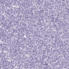Immunohistochemical staining of human tonsil shows no positivity in germinal center cells as expected.