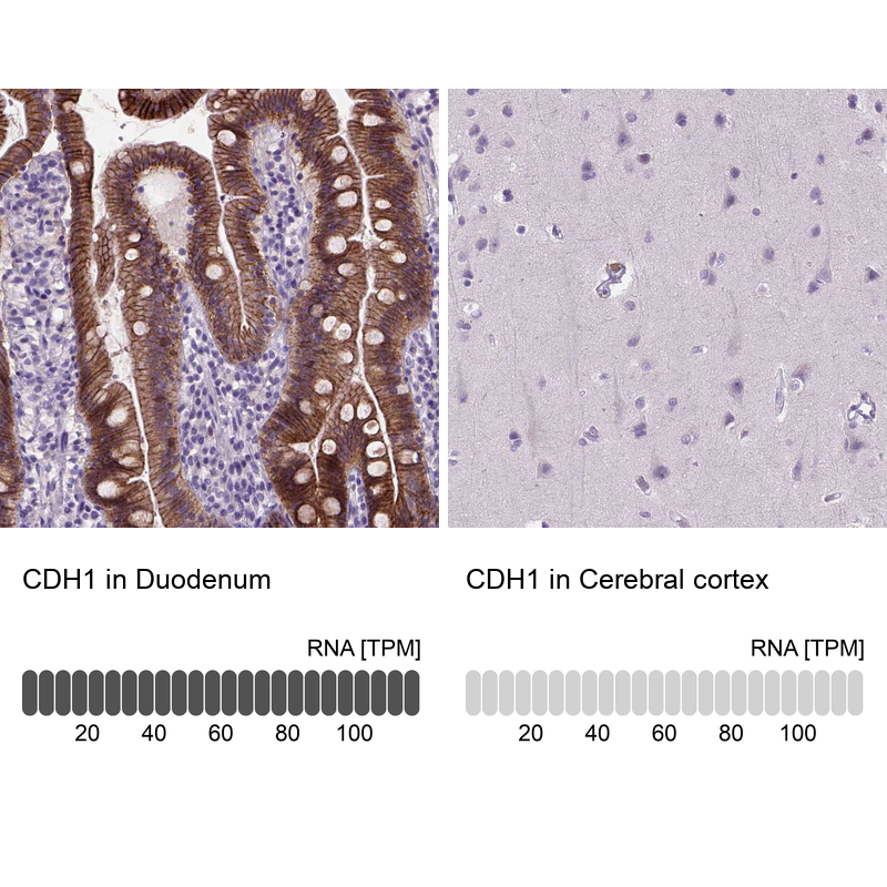 Anti-CDH1 Antibody