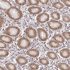 Anti-PSMA4 Antibody