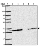 Lane 1: Marker [kDa] 250, 130, 95, 72, 55, 36, 28, 17, 10_br/_Lane 2: Human cell line RT-4_br/_Lane 3: Human cell line U-251 MG_br/_Lane 4: Human plasma_br/_Lane 5: Human Liver tissue_br/_Lane 6: Human Tonsil tissue