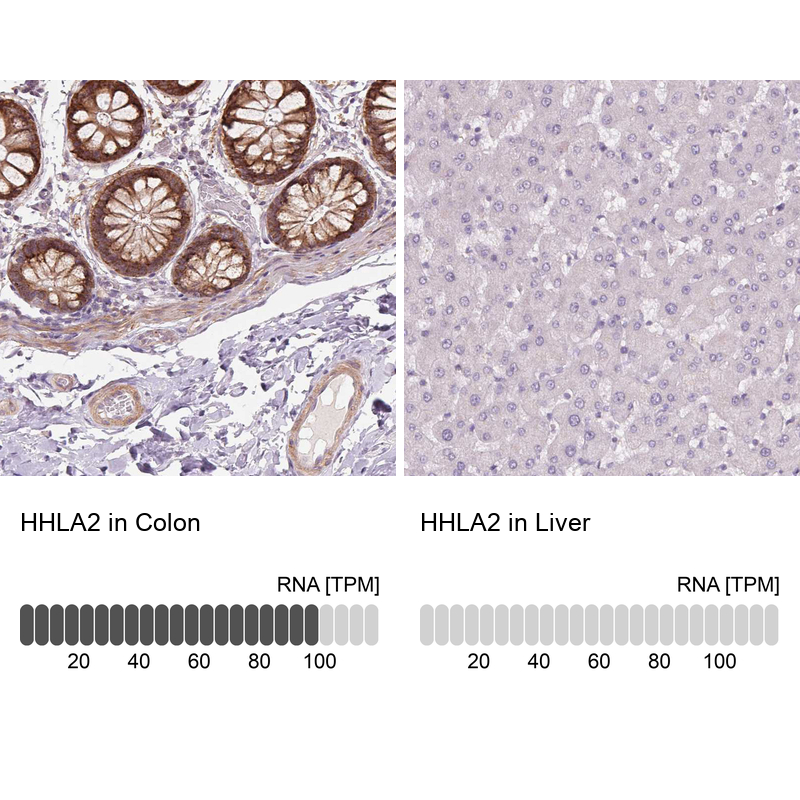 Anti-HHLA2 Antibody