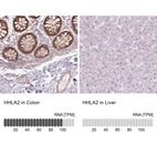 Anti-HHLA2 Antibody