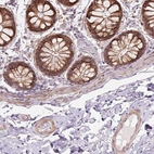 Immunohistochemical staining of human colon shows strong granular cytoplasmic positivity in glandular cells.
