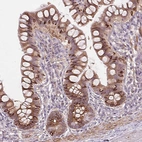 Immunohistochemical staining of human small intestine shows moderate to strong granular cytoplasmic positivity in glandular cells.