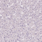 Immunohistochemical staining of human liver shows no positivity in hepatocytes as expected.
