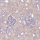 Immunohistochemical staining of human kidney shows weak cytoplasmic positivity in cells in tubules.