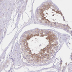 Anti-ZNF101 Antibody