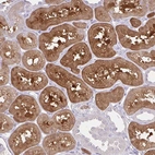 Immunohistochemical staining of human kidney shows strong cytoplasmic positivity in cells in tubules.