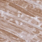 Immunohistochemical staining of human skeletal muscle shows moderate cytoplasmic positivity in myocytes.