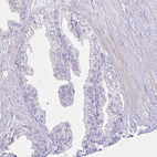 Immunohistochemical staining of human prostate shows no positivity in glandular cells as expected.