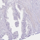Immunohistochemical staining of human prostate shows no positivity in glandular cells as expected.