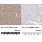 Anti-PACSIN1 Antibody