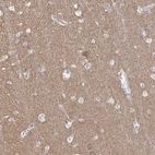 Immunohistochemical staining of human cerebral cortex shows high expression.