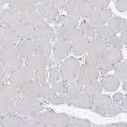 Immunohistochemical staining of human skeletal muscle shows low expression as expected.