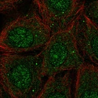 Immunofluorescent staining of human cell line MCF7 shows localization to nucleus, nucleoli & vesicles.