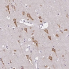 Anti-ZFYVE26 Antibody