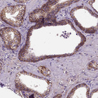 Anti-CDH1 Antibody