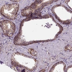 Immunohistochemical staining of human prostate shows strong membranous positivity in glandular cells.