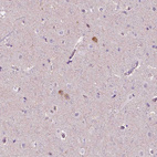 Immunohistochemical staining of human cerebral cortex shows moderate cytoplasmic positivity in a subset of neurons.