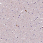 Anti-NOS1AP Antibody