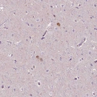 Immunohistochemical staining of human cerebral cortex shows moderate cytoplasmic positivity in a subset of neurons.