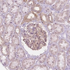 Immunohistochemical staining of human kidney shows strong membranous positivity in cells in glomeruli.