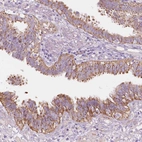 Immunohistochemical staining of human fallopian tube shows strong cytoplasmic positivity in glandular cells.