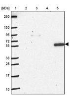 Lane 1: Marker [kDa] 250, 130, 95, 72, 55, 36, 28, 17, 10_br/_Lane 2: Human cell line RT-4_br/_Lane 3: Human cell line U-251 MG_br/_Lane 4: Human plasma_br/_Lane 5: Human Liver tissue