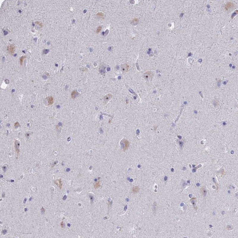 Anti-NOXRED1 Antibody