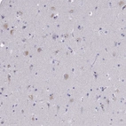 Anti-NOXRED1 Antibody