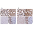 Immunohistochemical staining of human colon, kidney, skeletal muscle and skin using Anti-TXN antibody HPA055752 (A) shows similar protein distribution across tissues to independent antibody HPA047478 (B).