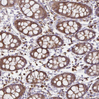 Immunohistochemical staining of human colon shows strong cytoplasmic positivity in glandular cells.