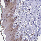 Immunohistochemical staining of human skin shows moderate cytoplasmic and nuclear positivity in squamous epithelial cells.