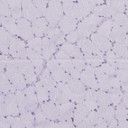 Immunohistochemical staining of human skeletal muscle shows no cytoplasmic positivity in myocytes as expected.