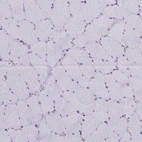 Immunohistochemical staining of human skeletal muscle shows no cytoplasmic positivity in myocytes as expected.