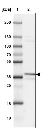 Lane 1: Marker [kDa] 250, 130, 100, 70, 55, 35, 25, 15, 10_br/_Lane 2: Human cell line A-549