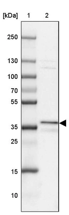 Lane 1: Marker [kDa] 250, 130, 100, 70, 55, 35, 25, 15, 10_br/_Lane 2: Human cell line A-549