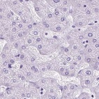 Anti-KRT12 Antibody