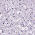 Immunohistochemical staining of human liver using Anti-KRT12 antibody HPA055835.