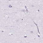 Immunohistochemical staining of human cerebral cortex using Anti-KRT12 antibody HPA055835.