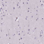 Immunohistochemical staining of human cerebral cortex shows no positivity in neuronal cells as expected.