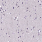 Immunohistochemical staining of human cerebral cortex shows no positivity in neuronal cells as expected.