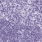Anti-KRT12 Antibody