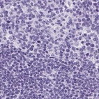 Immunohistochemical staining of human lymph node using Anti-KRT12 antibody HPA055835.