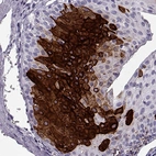 Immunohistochemical staining of human eye using Anti-KRT12 antibody HPA055835.